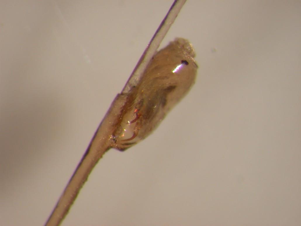 Can Lice Eggs Survive On Furniture at Luis Newell blog