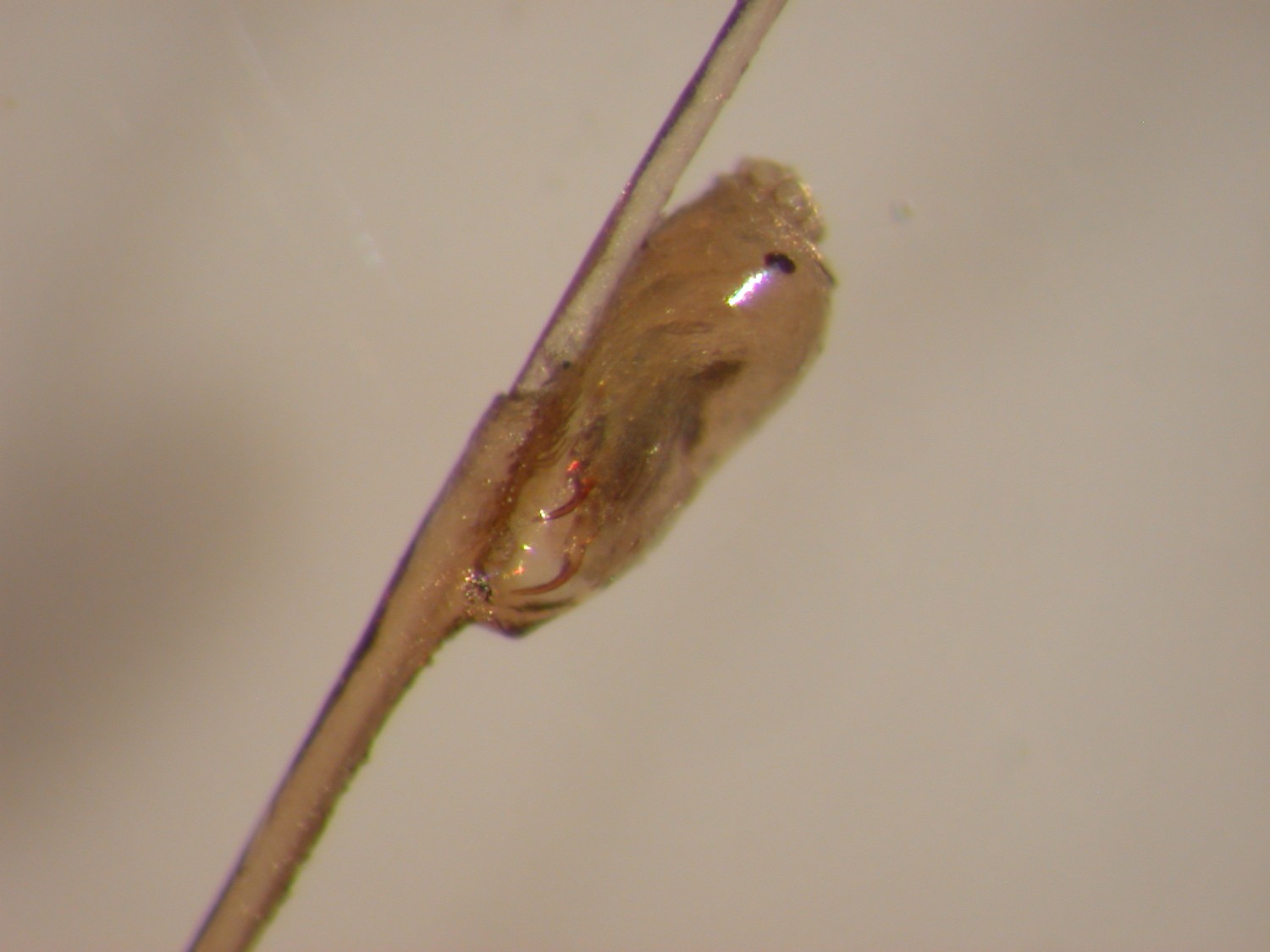 The Shocking Reality What Color Are Lice Eggs When They Are Attached - w8up3ty