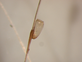 Empty Hatched Lice Egg (Nit): A Sign of Past Lice Activity on the Scalp