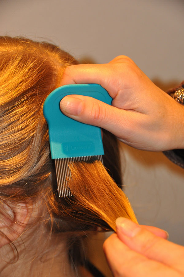 Combing for dead Head lice and living lice and Nits