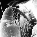 Head louse – close up of leg with receptors